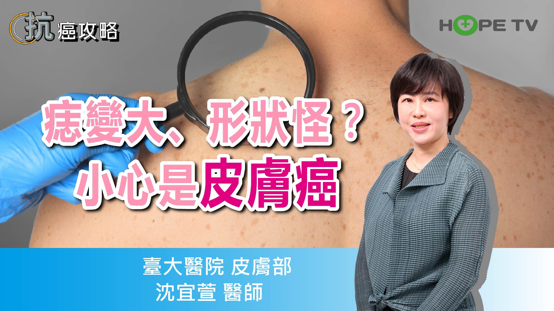 痣變大、形狀怪？小心是皮膚癌〡ft. 臺大醫院皮膚部 沈宜萱醫師 〡【抗癌攻略】