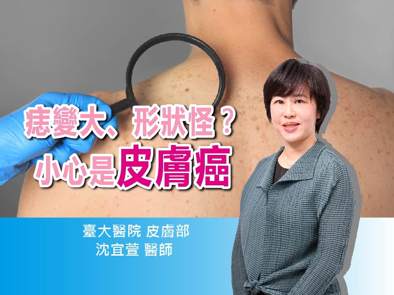 痣變大、形狀怪？小心是皮膚癌〡ft. 臺大醫院皮膚部 沈宜萱醫師 〡【抗癌攻略】