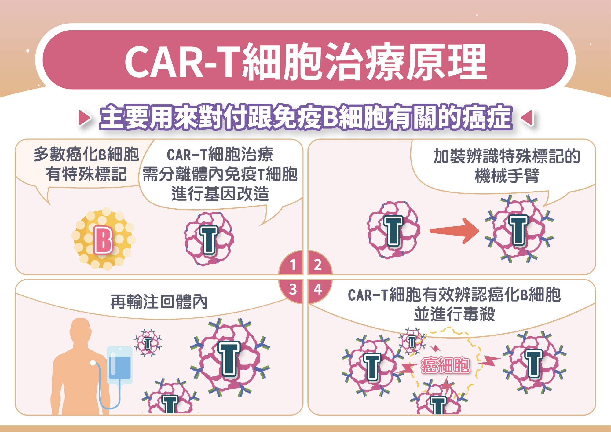 CART細胞治療原理