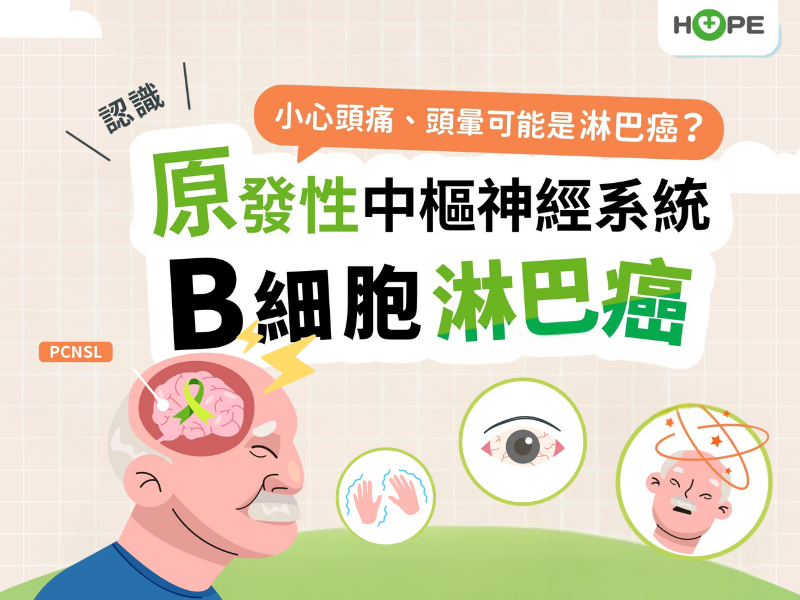 小心頭痛、頭暈可能是淋巴癌？認識原發性中樞神經系統B細胞淋巴癌！