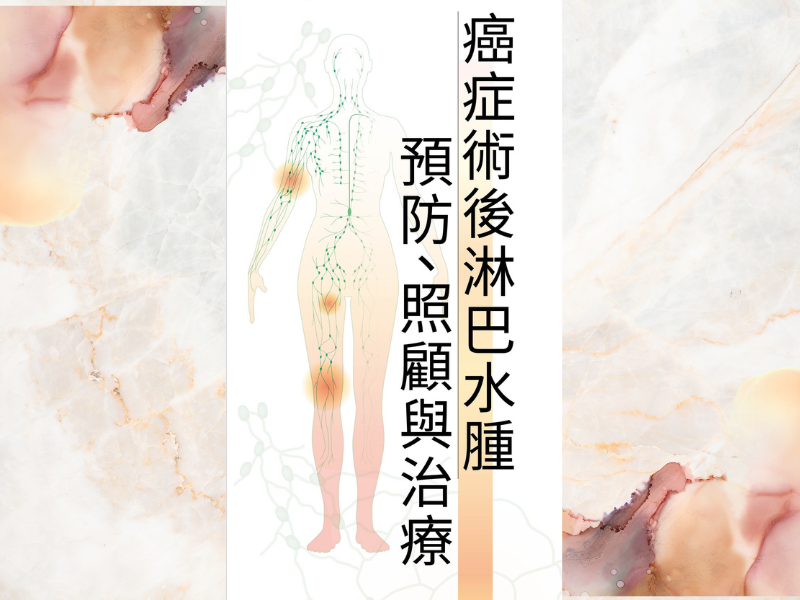 癌症術後淋巴水腫預防、照顧與治療
